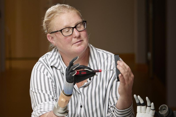 Bionic hand integrates with Swedish woman's nerves, bones, muscles