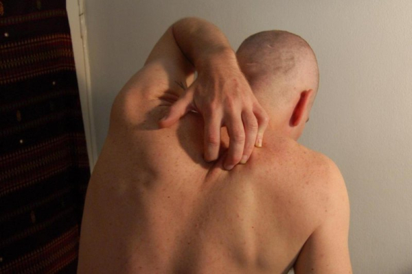 Can't sleep? Your skin might be to blame, study says