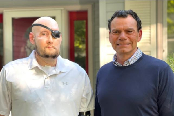 Arkansas man receives first-ever face transplant, including whole new eye