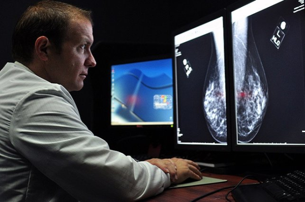 False-positive mammogram linked to higher risk of breast cancer
