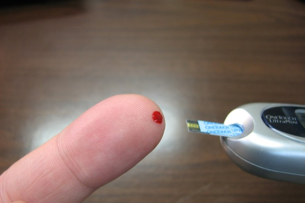 FDA warns against using some smartwatches, rings to check blood glucose levels