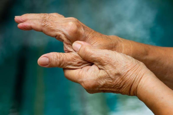Rheumatoid arthritis drug abatacept may also prevent the disease