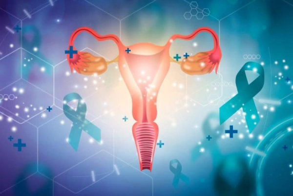 AI may help detect signs of ovarian cancer in the blood