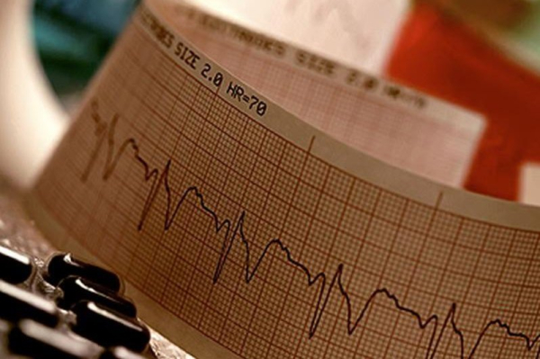 Atrial fibrillation becoming more common in middle-aged people