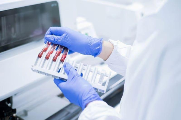 Blood test may improve detection of pancreatic cancers