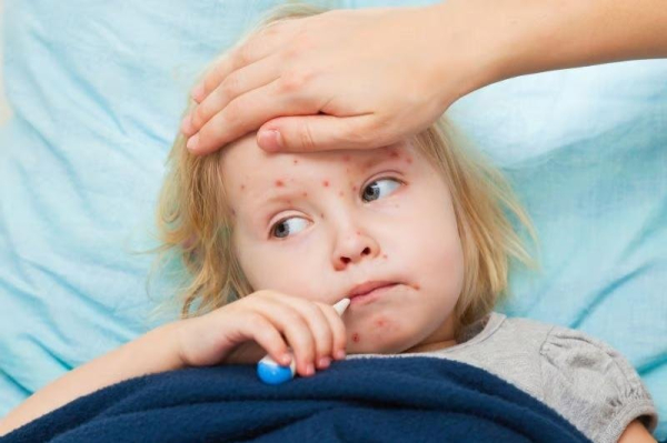 Babies born by C-section need two doses of measles vaccine to produce antibodies