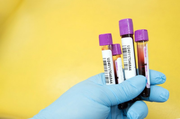 Panel recommends blood test to detect colon cancer for FDA approval Panel recommends blood test to detect colon cancer for FDA approval