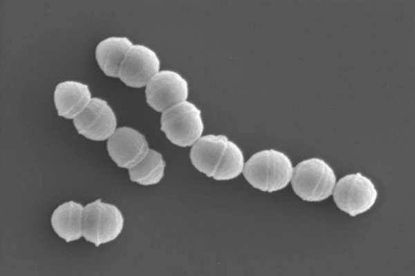 Japan sees record spike in infections caused by tissue-damaging bacteria