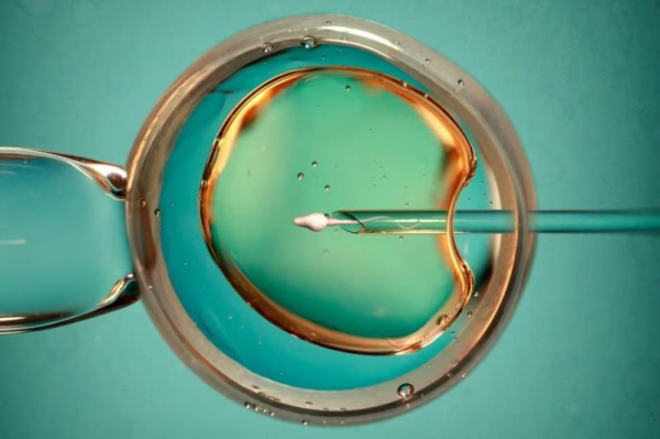 Air pollution linked to drop in live births among IVF patients