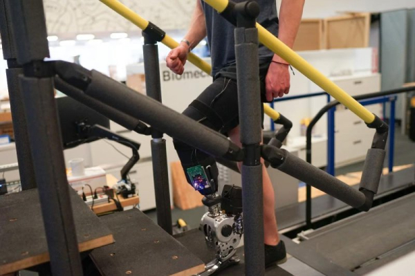 'Smart' prosthetic legs help create natural gait