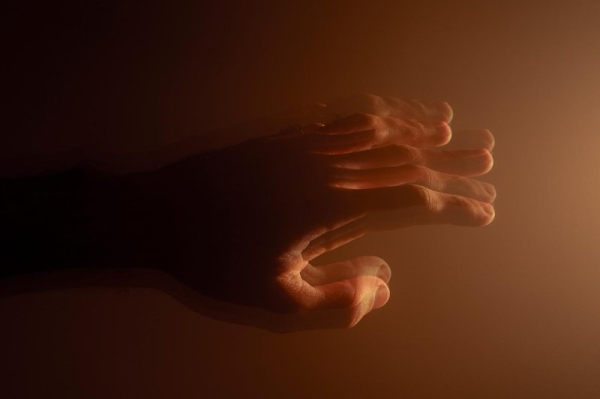 In Parkinson's, dementia may occur less often or later than believed, study says