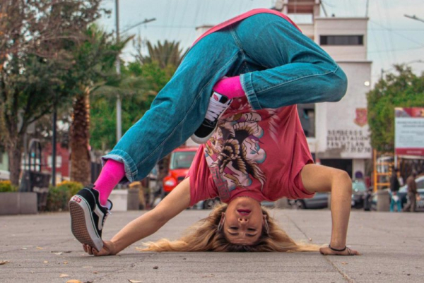 Breakdancers risk 'headspin hole' or lump on scalp, study warns Breakdancers risk 'headspin hole' or lump on scalp, study warns