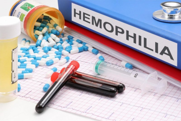 FDA approves first once-weekly drug treatment regimen for hemophilia
