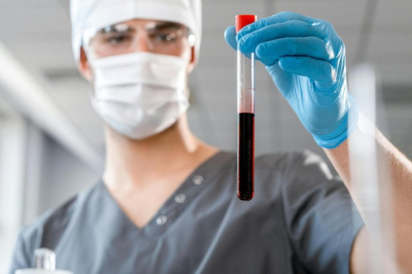 Long-term exposure to air pollution tied to clots in veins that bring blood to heart