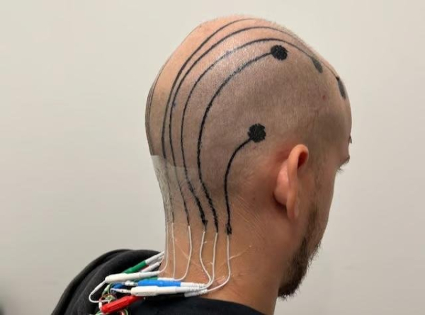 Researchers use temporary scalp tattoo to track brainwaves