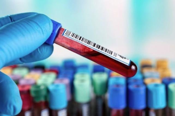 Blood test can help diagnose, track ALS patients, French study indicates Blood test can help diagnose, track ALS patients, French study indicates