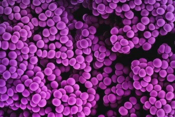 Diabetes can drive antibiotic resistance to staph, study finds Diabetes can drive antibiotic resistance to staph, study finds