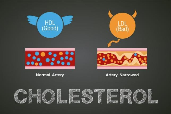 2 drug combination lowers cholesterol better than just a statin, researchers say