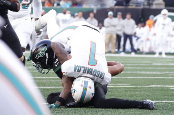 Concussion damage lingers In athletes' brains up to a year