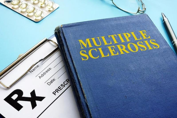 Blood test might predict symptoms relapse in MS patients
