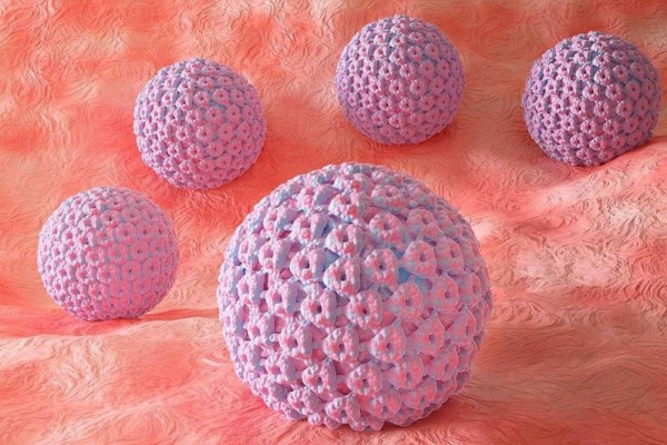 Cervical cancer survivors may be at higher risk for anal cancer