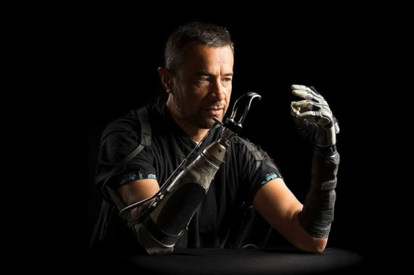 Researchers say AI-powered bionic hand offers improved dexterity