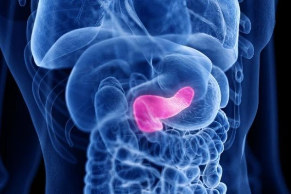 Risk score helps predict pancreatic cancer recurrence, study says